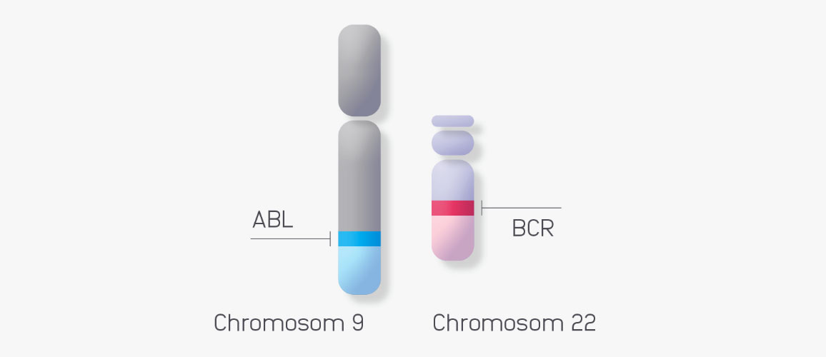 Schematische Darstellung der Chromosomen 9 und 22 auf denen die Gene BCR und ABL lokalisert sind.
